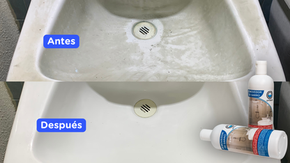 Removedor de Sarro Optimum – Limpieza profunda profesional